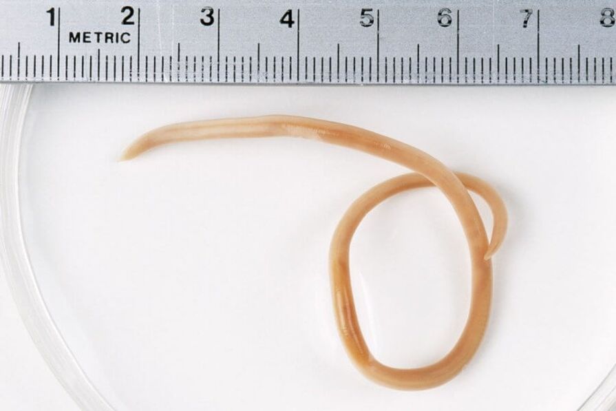pinworm az emberi testből