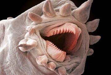 milyen férgek élhetnek az emberi szervezetben